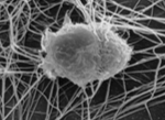 Scanning electron microscope image of a dendritic cell