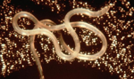 Picture of a loaloa parasite