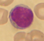 Microscope image of a stained lymphocyte
